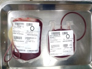 Leia mais sobre o artigo Transfusões de sangue na Santa Casa salvam vidas de bebês e gestantes