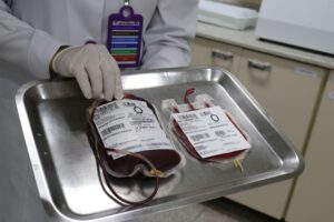 Leia mais sobre o artigo Aliquotagem de bolsas de sangue na Santa Casa atende especificidade de recém nascidos internados